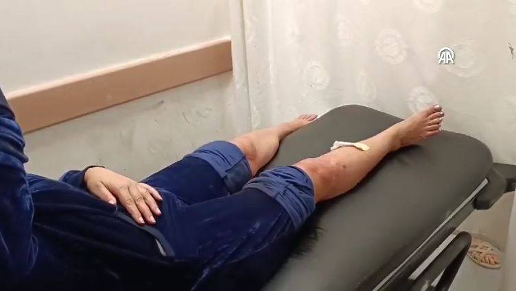 Bu tehlikeye kim dur diyecek! Sokak köpekleri sahilde yürüyen kadına saldırdı - Resim: 7